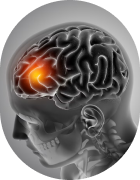 Brain Health